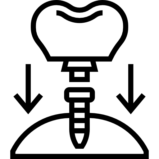 Impianti dentali