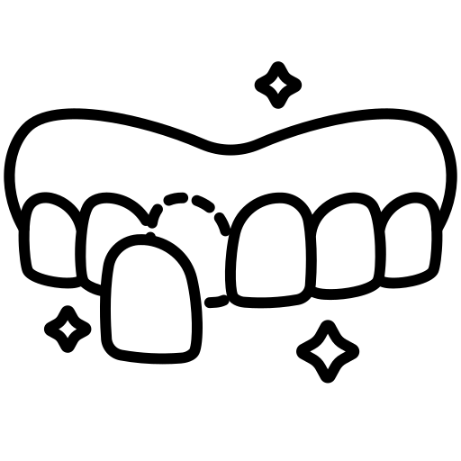 Faccette dentali